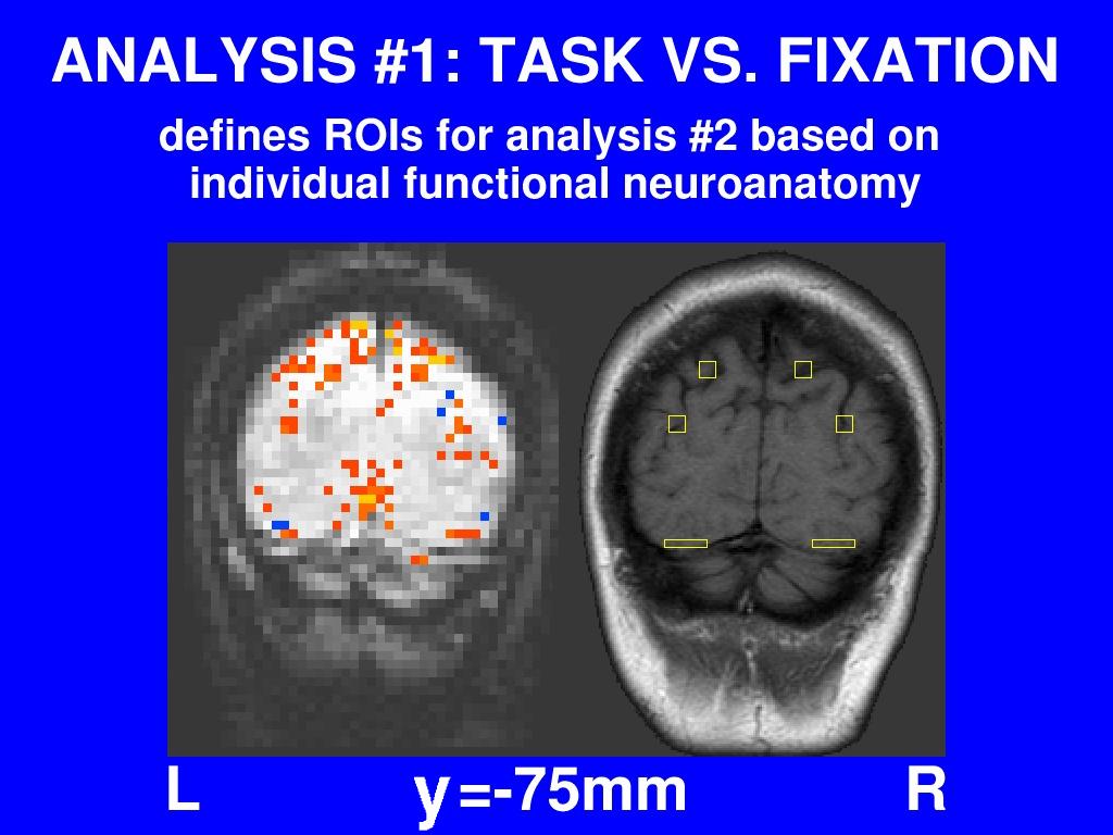 fMRI analysis #1
