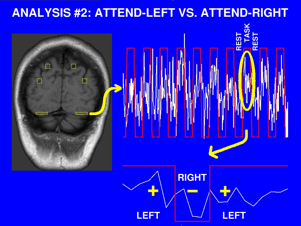 fMRI analysis #2