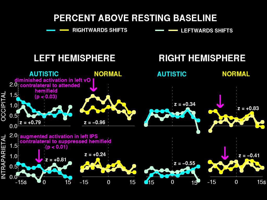 autistic fMRI results