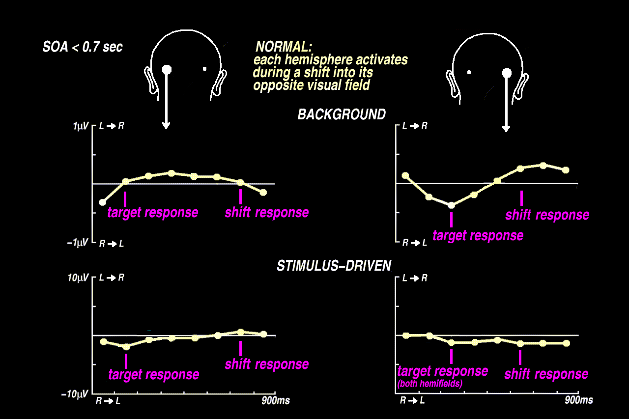 previous normal EEG results