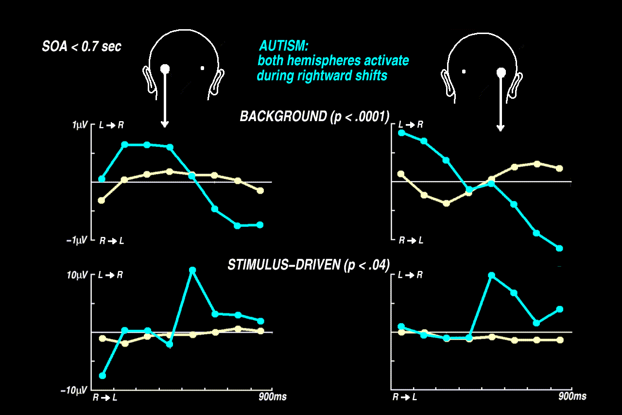 the autistic brain responds with a generalised arousal, in both hemispheres, always greater in the case of rightward shifts